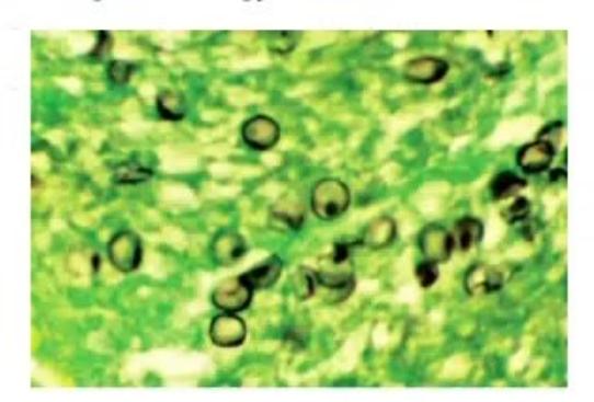 images/MNJ-P-OSCE 23. Infectious disease_page_12_Picture_10.jpeg