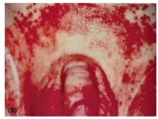 images/MNJ-P-OSCE 23. Infectious disease_page_12_Picture_3.jpeg