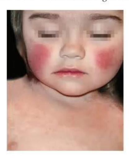 images/MNJ-P-OSCE 23. Infectious disease_page_13_Picture_15.jpeg