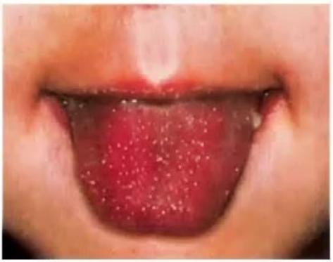images/MNJ-P-OSCE 23. Infectious disease_page_14_Picture_14.jpeg