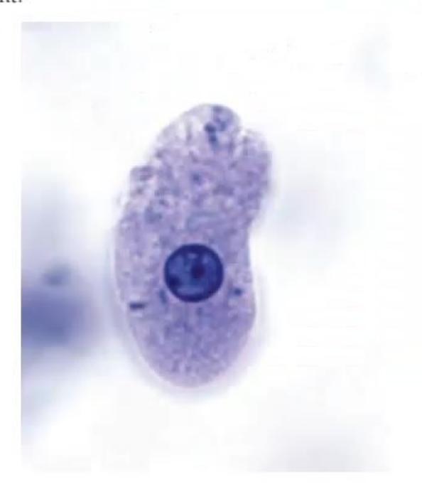 images/MNJ-P-OSCE 23. Infectious disease_page_15_Picture_32.jpeg