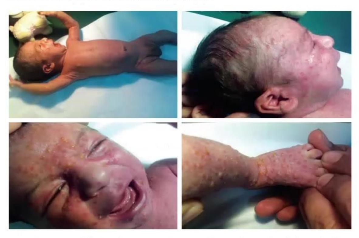 images/MNJ-P-OSCE 23. Infectious disease_page_16_Picture_6.jpeg