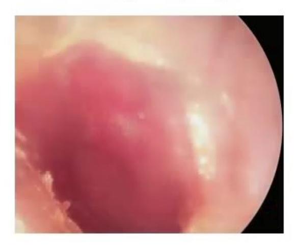 images/MNJ-P-OSCE 23. Infectious disease_page_17_Picture_8.jpeg