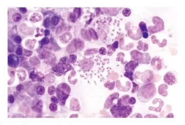 images/MNJ-P-OSCE 23. Infectious disease_page_6_Picture_16.jpeg