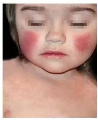 images/MNJ-P-OSCE 23. Infectious disease_page_6_Picture_26.jpeg
