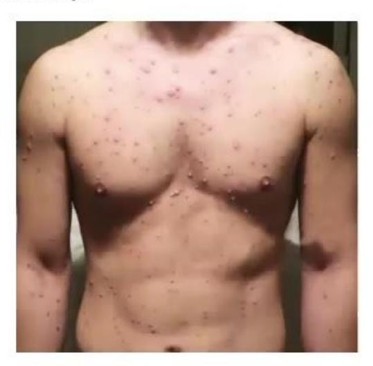 images/MNJ-P-OSCE 23. Infectious disease_page_9_Picture_7.jpeg