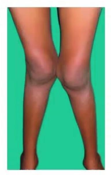 images/MNJ-P-OSCE 26. Musculoskeletal system_page_4_Picture_2.jpeg