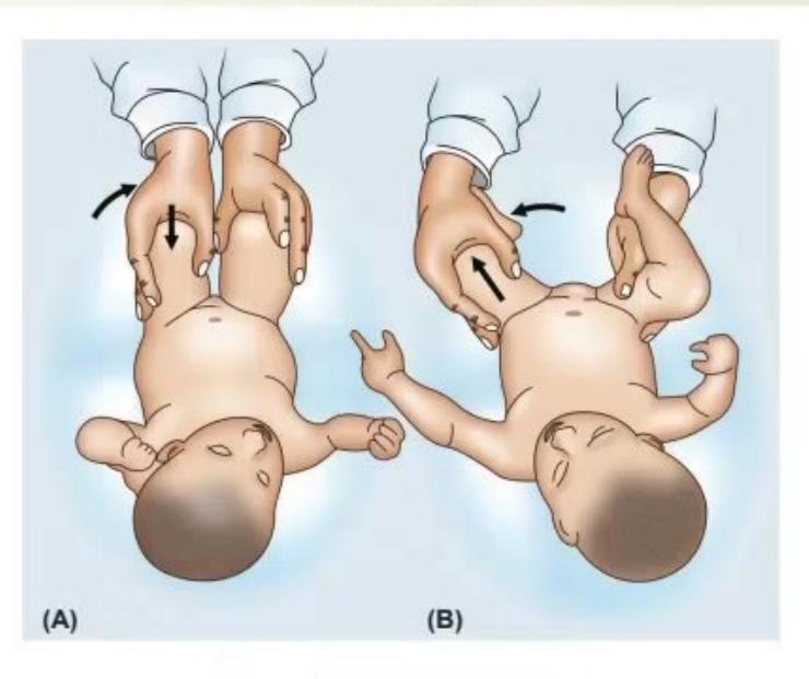 images/MNJ-P-OSCE 26. Musculoskeletal system_page_5_Picture_2.jpeg