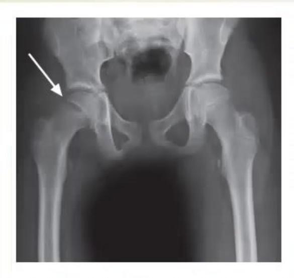 images/MNJ-P-OSCE 26. Musculoskeletal system_page_6_Picture_2.jpeg