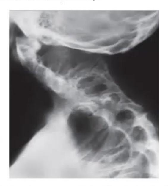images/MNJ-P-OSCE 26. Musculoskeletal system_page_6_Picture_7.jpeg