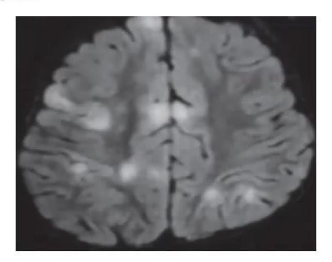 images/MNJ-P-OSCE 27. Neurology_page_0_Picture_9.jpeg