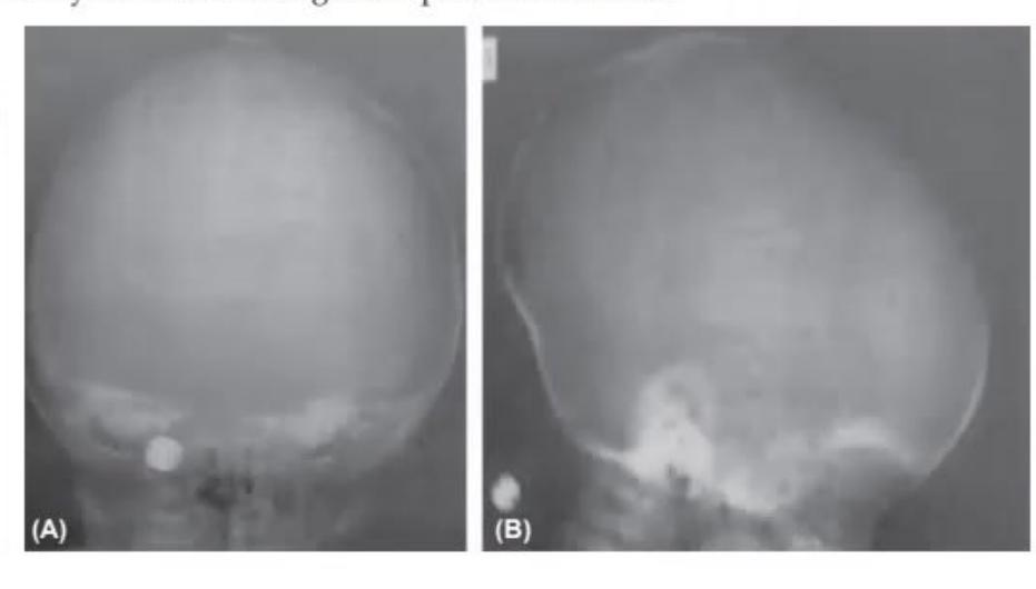 images/MNJ-P-OSCE 27. Neurology_page_12_Picture_12.jpeg
