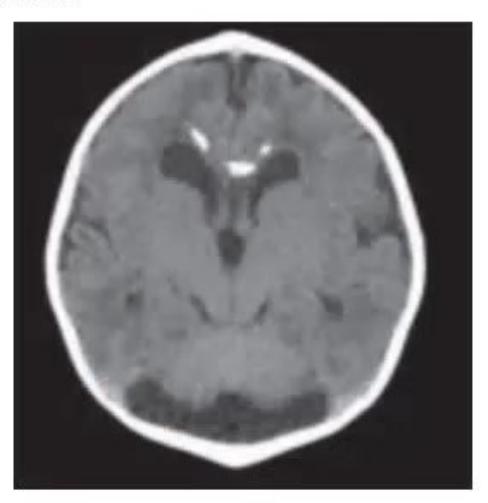 images/MNJ-P-OSCE 27. Neurology_page_12_Picture_7.jpeg