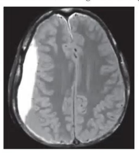 images/MNJ-P-OSCE 27. Neurology_page_16_Picture_14.jpeg