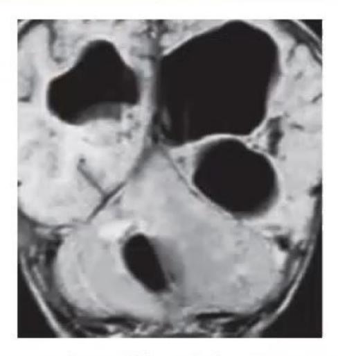 images/MNJ-P-OSCE 27. Neurology_page_1_Picture_1.jpeg