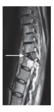 images/MNJ-P-OSCE 27. Neurology_page_1_Picture_5.jpeg