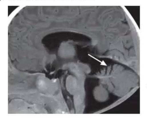 images/MNJ-P-OSCE 27. Neurology_page_1_Picture_9.jpeg