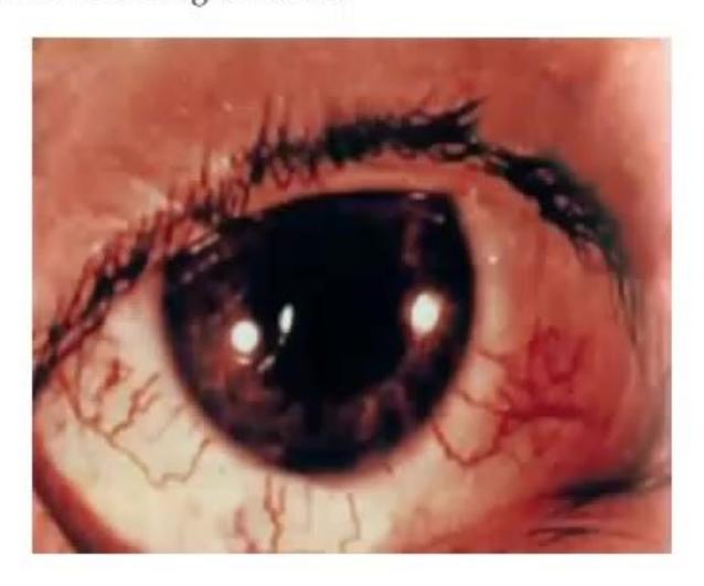 images/MNJ-P-OSCE 27. Neurology_page_2_Picture_10.jpeg