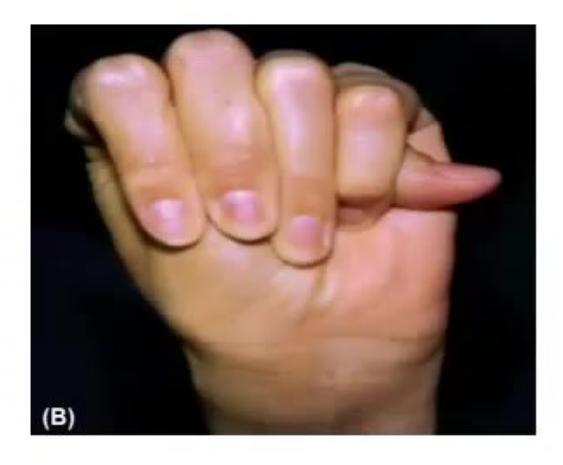 images/MNJ-P-OSCE 27. Neurology_page_3_Picture_13.jpeg
