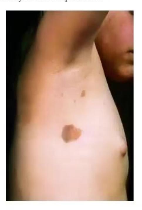 images/MNJ-P-OSCE 27. Neurology_page_3_Picture_6.jpeg