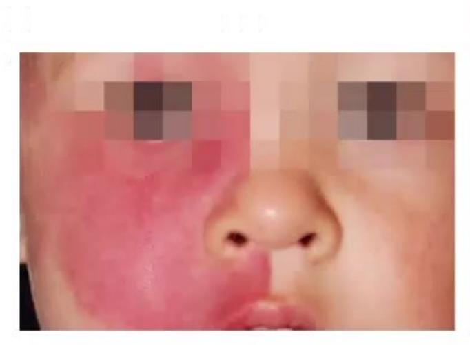 images/MNJ-P-OSCE 27. Neurology_page_4_Picture_6.jpeg