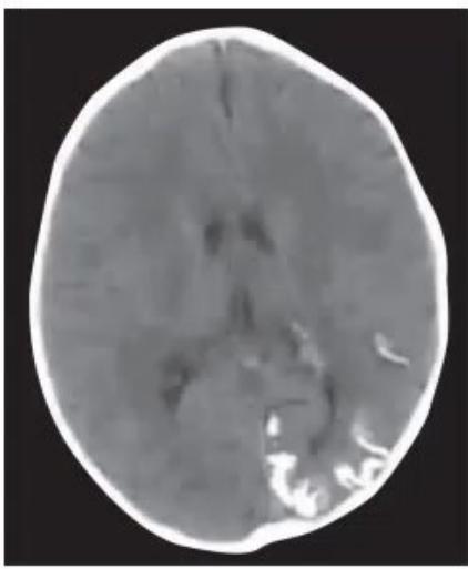 images/MNJ-P-OSCE 27. Neurology_page_4_Picture_7.jpeg