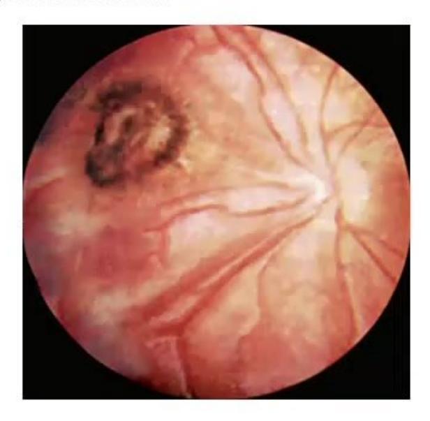 images/MNJ-P-OSCE 27. Neurology_page_6_Picture_10.jpeg
