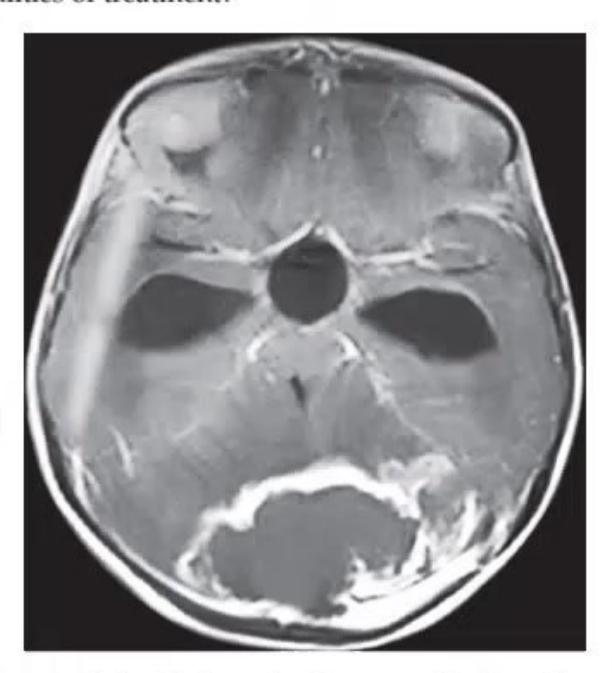 images/MNJ-P-OSCE 27. Neurology_page_6_Picture_5.jpeg