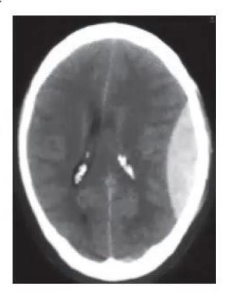 images/MNJ-P-OSCE 27. Neurology_page_7_Picture_12.jpeg