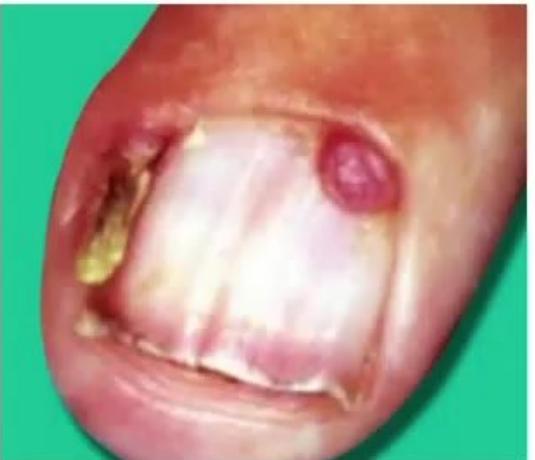 images/MNJ-P-OSCE 27. Neurology_page_8_Picture_10.jpeg