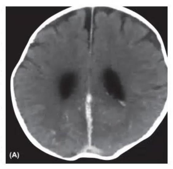 images/MNJ-P-OSCE 27. Neurology_page_8_Picture_2.jpeg