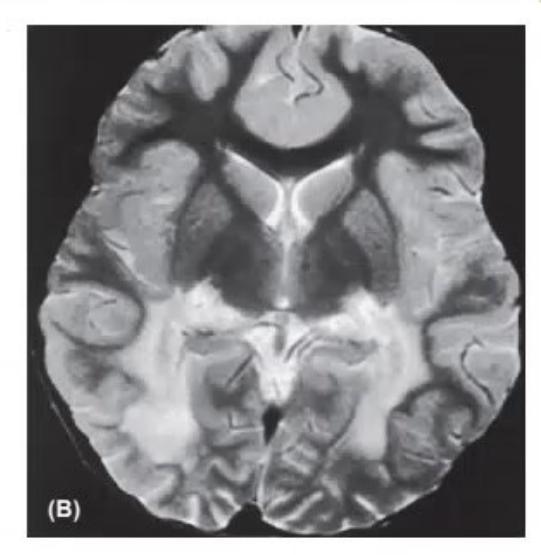 images/MNJ-P-OSCE 27. Neurology_page_8_Picture_3.jpeg