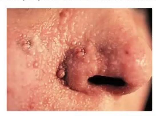 images/MNJ-P-OSCE 27. Neurology_page_8_Picture_8.jpeg