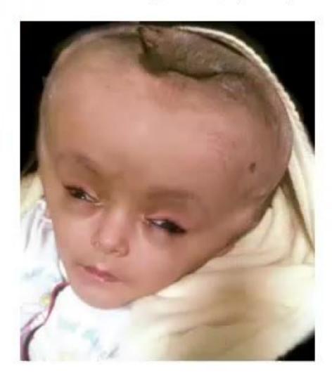 images/MNJ-P-OSCE 27. Neurology_page_9_Picture_12.jpeg