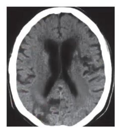 images/MNJ-P-OSCE 27. Neurology_page_9_Picture_13.jpeg