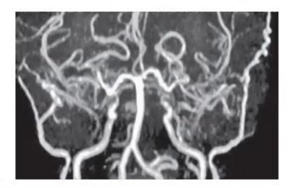 images/MNJ-P-OSCE 27. Neurology_page_9_Picture_7.jpeg