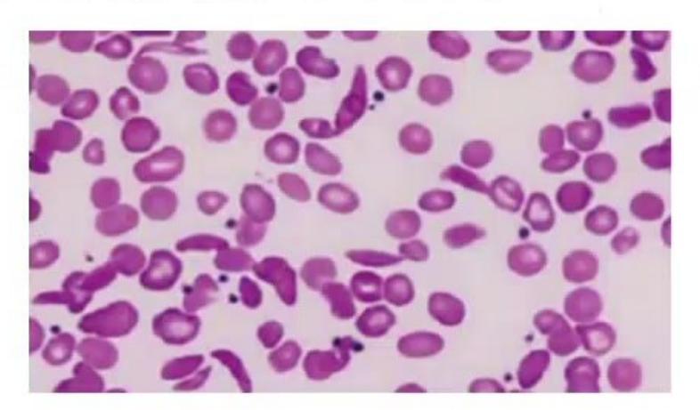 images/MNJ-P-OSCE 28. Hematoncology_page_0_Picture_8.jpeg
