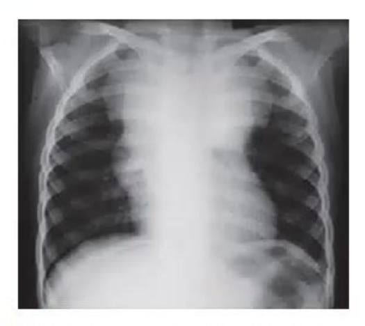 images/MNJ-P-OSCE 28. Hematoncology_page_1_Picture_4.jpeg