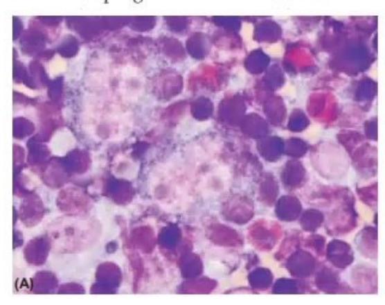 images/MNJ-P-OSCE 28. Hematoncology_page_3_Picture_7.jpeg
