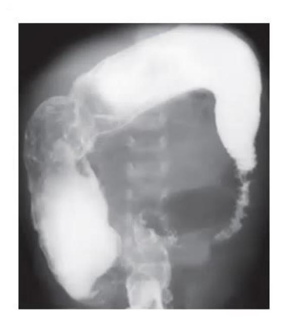 images/MNJ-P-OSCE 30. Gastroenterology_page_10_Picture_15.jpeg