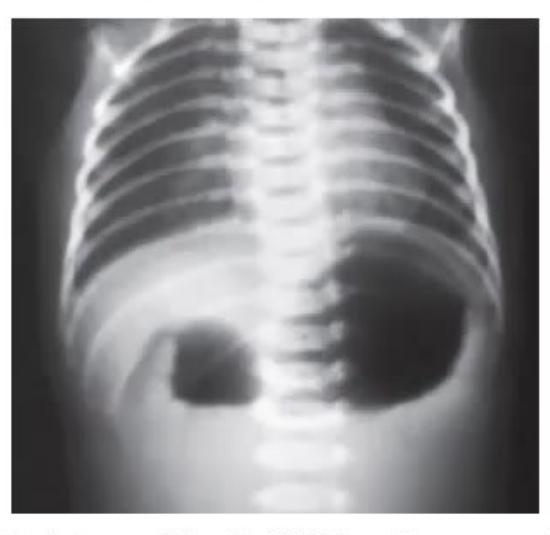 images/MNJ-P-OSCE 30. Gastroenterology_page_10_Picture_7.jpeg