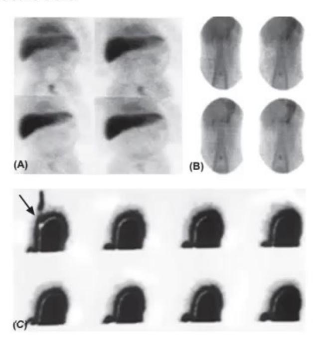images/MNJ-P-OSCE 30. Gastroenterology_page_11_Picture_12.jpeg