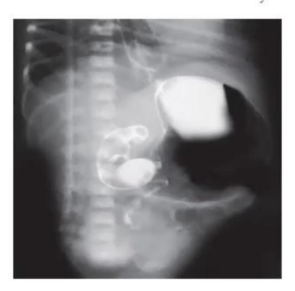 images/MNJ-P-OSCE 30. Gastroenterology_page_11_Picture_8.jpeg