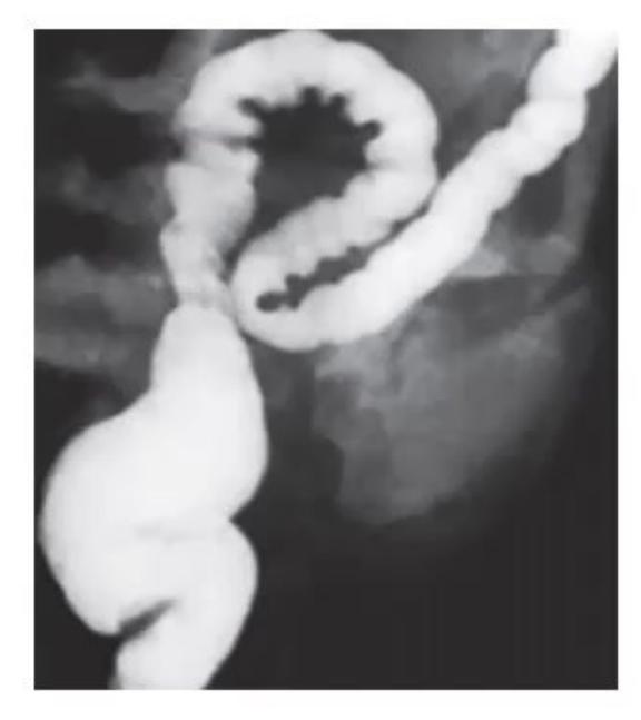 images/MNJ-P-OSCE 30. Gastroenterology_page_12_Picture_12.jpeg