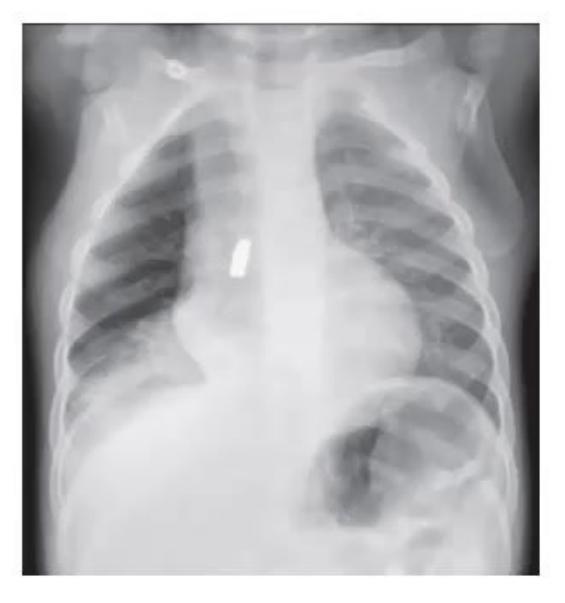 images/MNJ-P-OSCE 30. Gastroenterology_page_12_Picture_6.jpeg