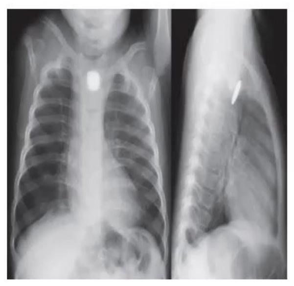 images/MNJ-P-OSCE 30. Gastroenterology_page_12_Picture_7.jpeg