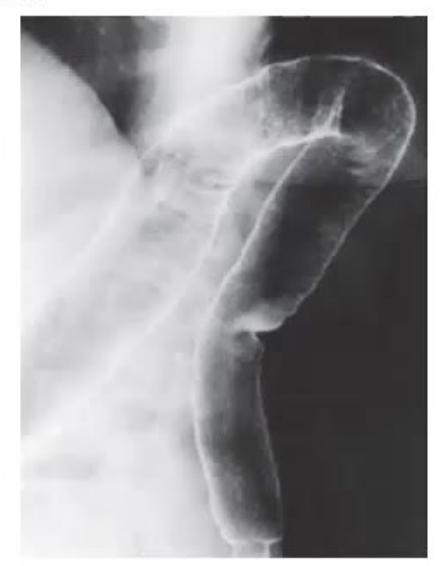 images/MNJ-P-OSCE 30. Gastroenterology_page_13_Picture_14.jpeg