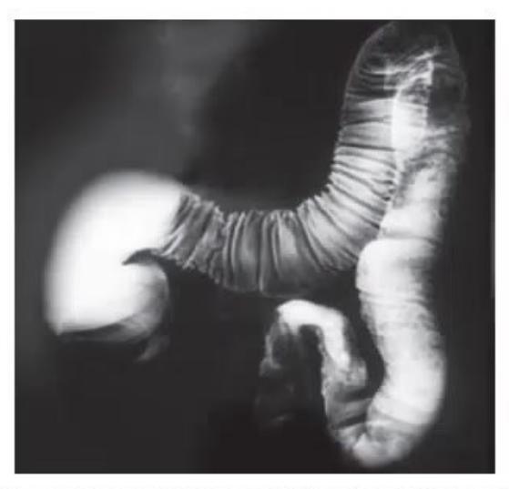images/MNJ-P-OSCE 30. Gastroenterology_page_13_Picture_8.jpeg