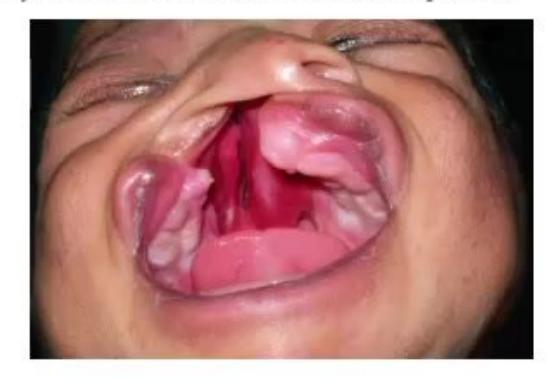 images/MNJ-P-OSCE 30. Gastroenterology_page_14_Picture_19.jpeg