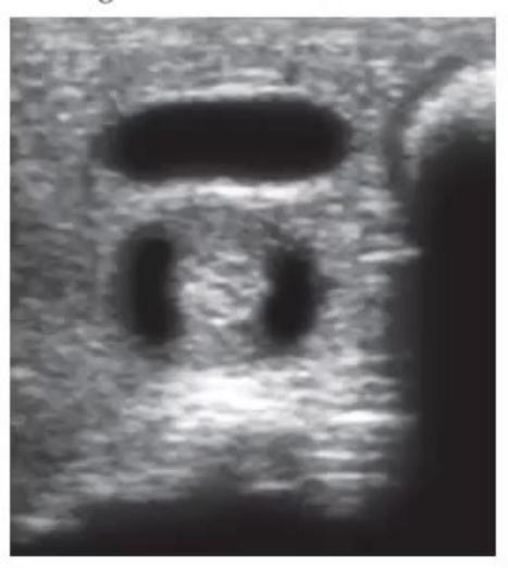 images/MNJ-P-OSCE 30. Gastroenterology_page_15_Picture_15.jpeg